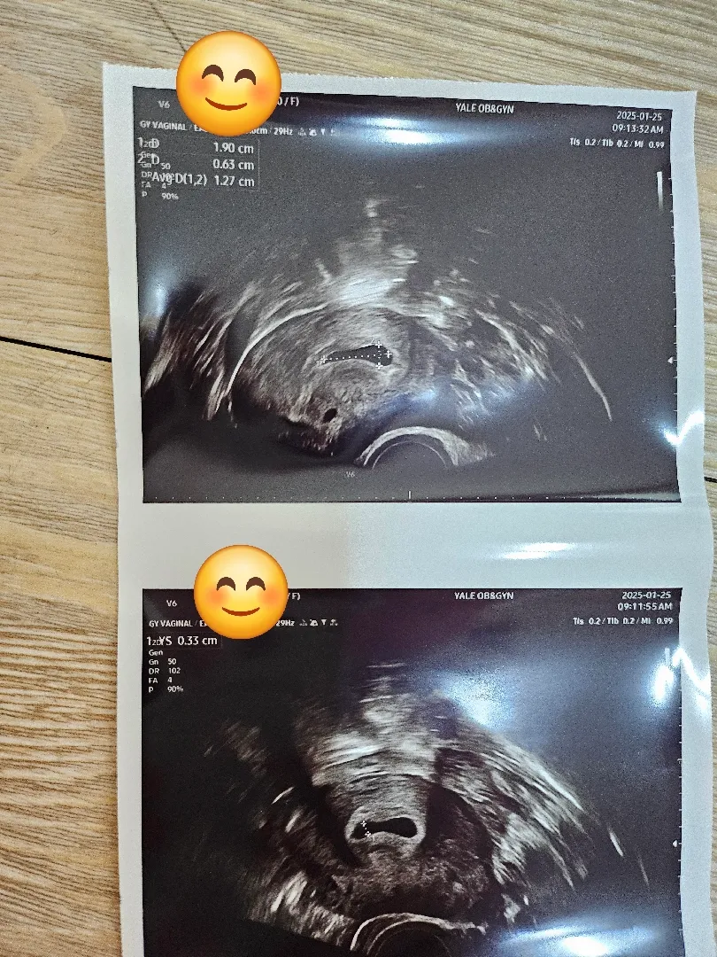 5주6일