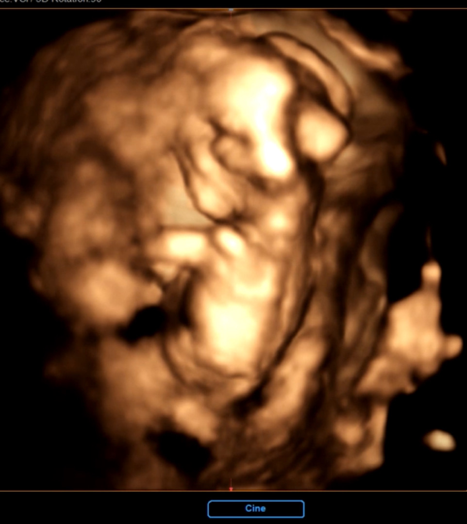 얼굴을 허락하지 않는 딸..🙃