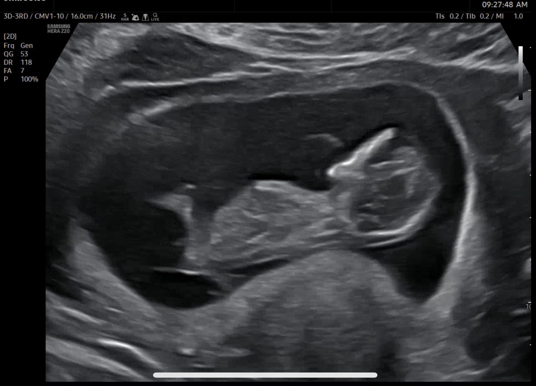 각도법 고수님들 부탁드립니다