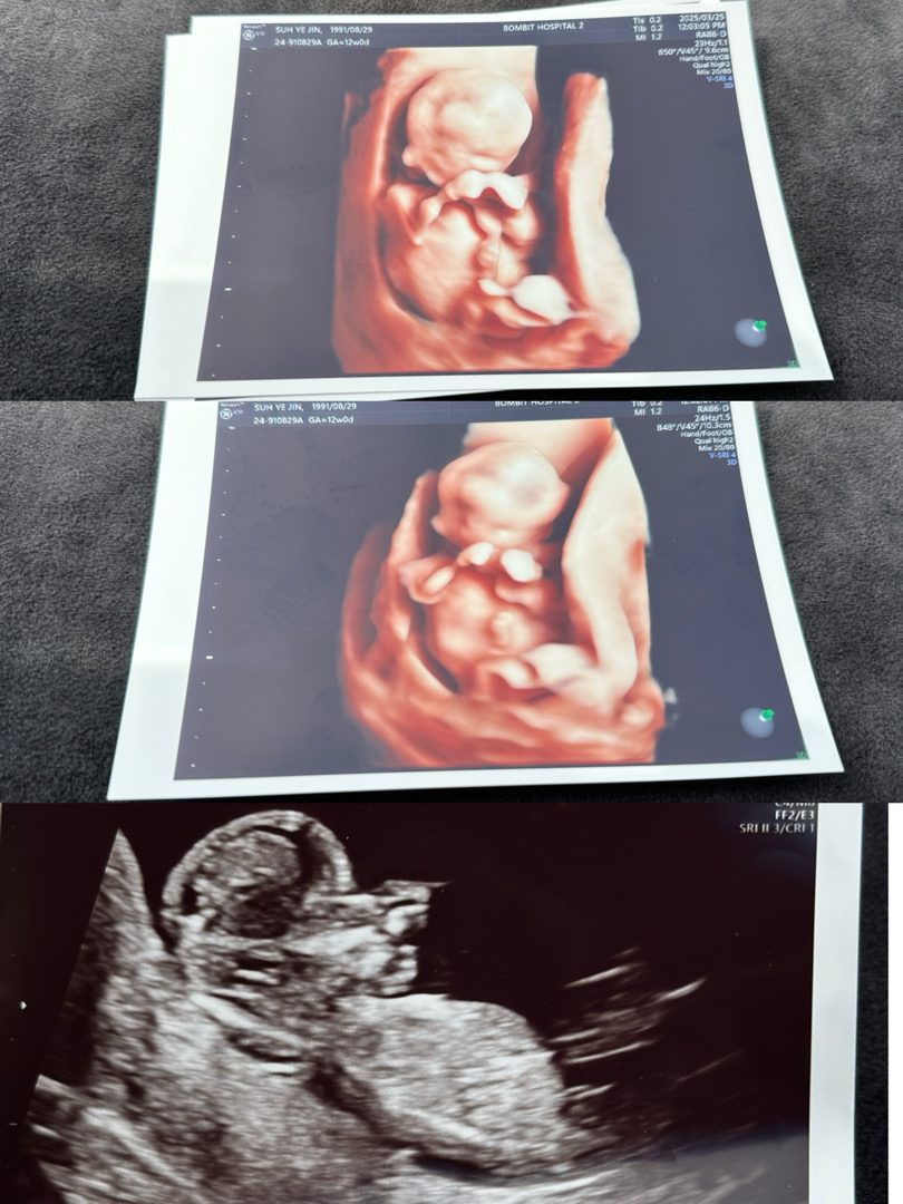 12주차 입체초음파 보고왔는데....!! 성별궁금해요