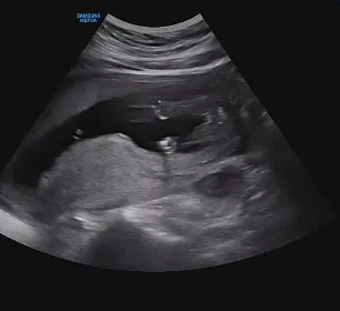 16주 되었어요 아들? 딸?