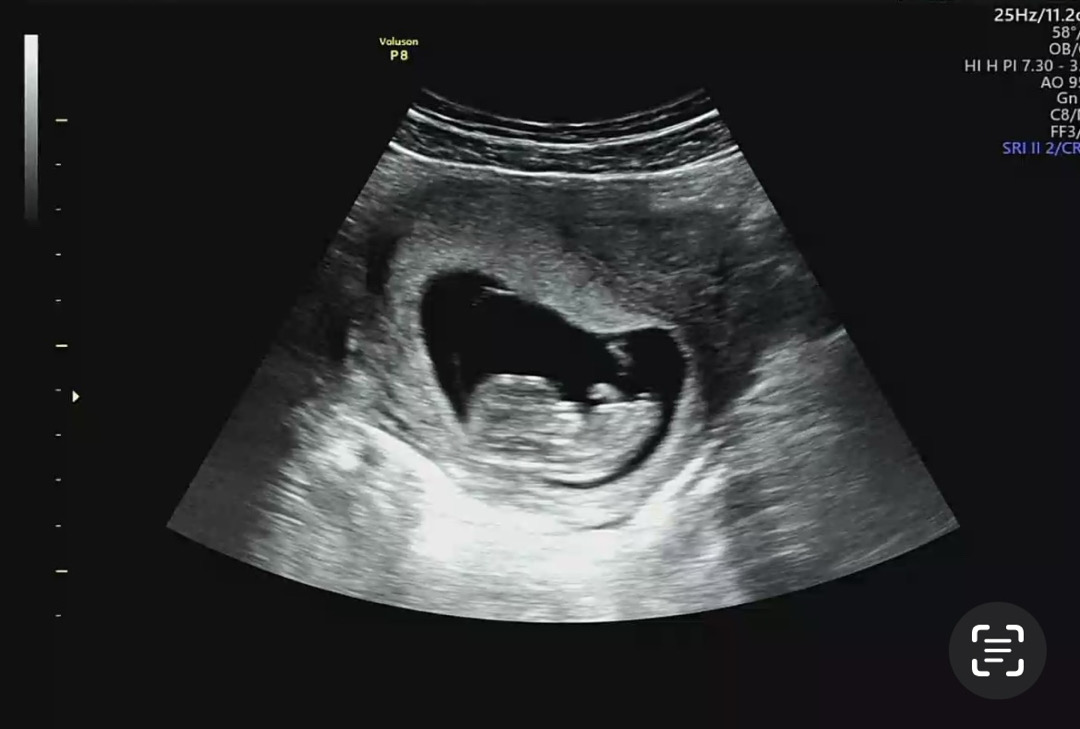 각도법 궁금해요 👶💕