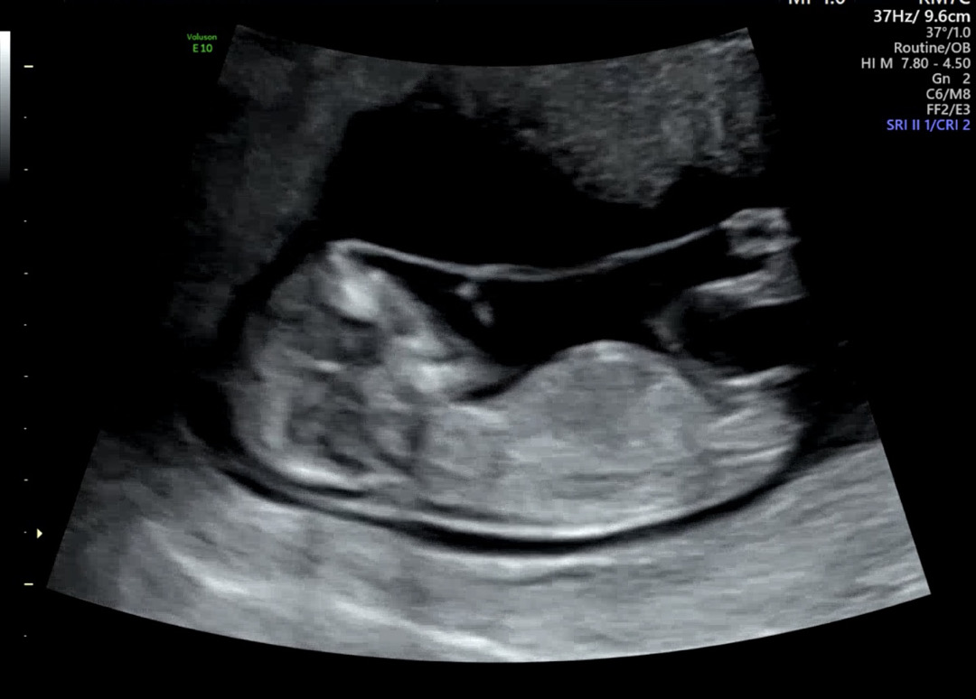 각도법 고수님들 봐주세요 👶💕