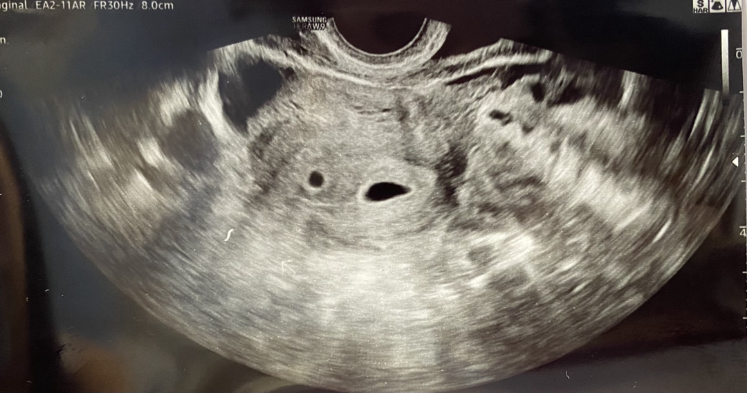 오늘 둥이 집들이 했어요