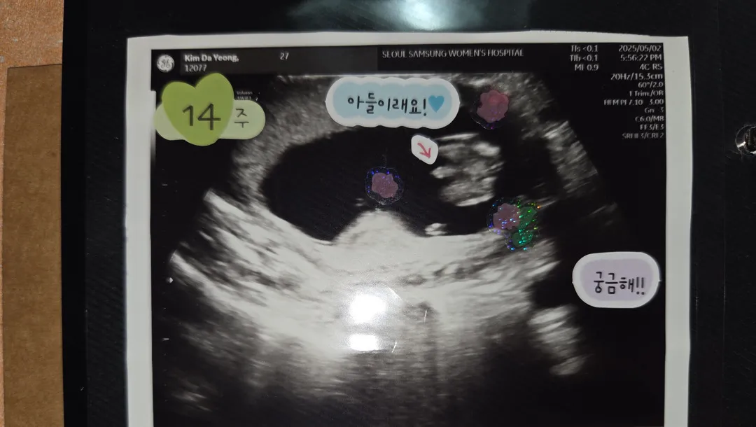 14주차에 생각보다 빨리 성별을 알게되었어요 ㅋㅋ