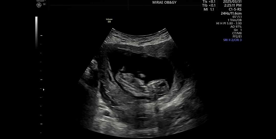 저도  성별이  궁금해요  