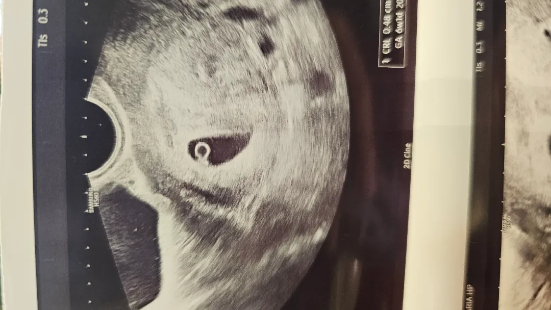 난황 보고왔어요 ! 6w4d