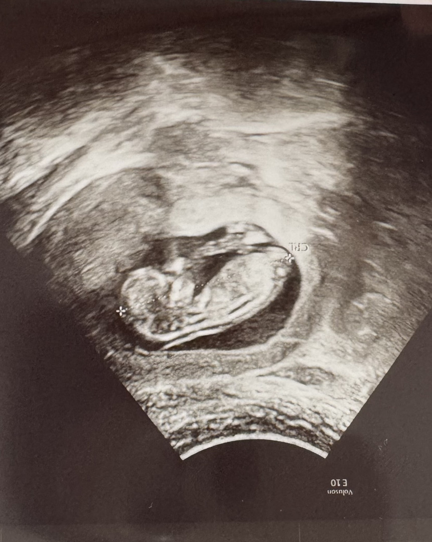 정밀초음파
