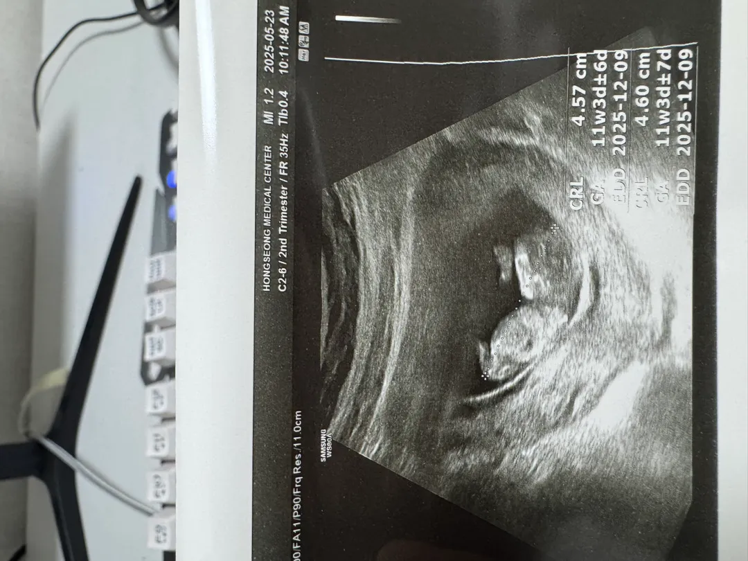 11주 각도법 한번만 봐주세요ŏ̥̥̥̥םŏ̥̥̥̥