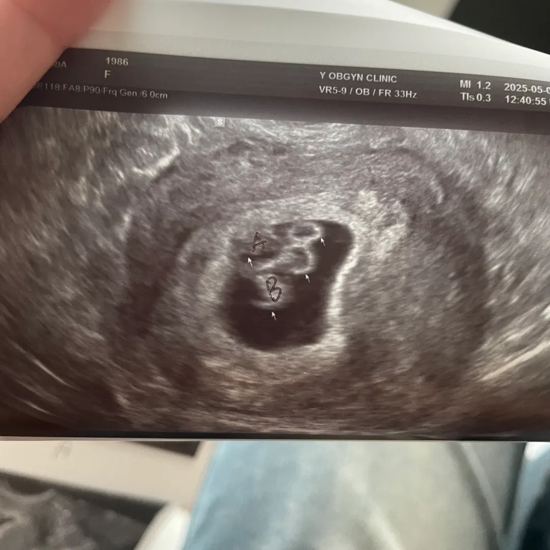 갑자기 쌍둥이맘이 되었어요...!