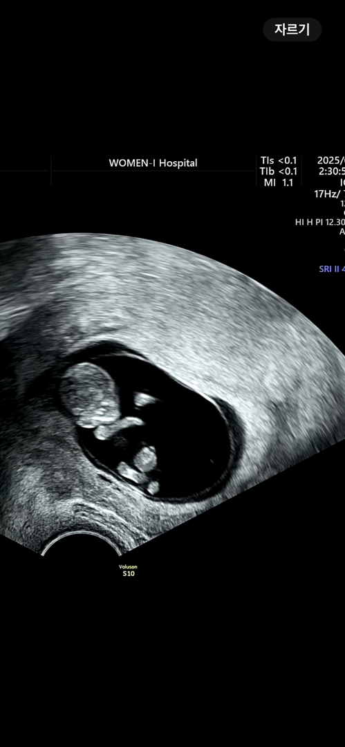9주차 젤리곰 너무 기여워요