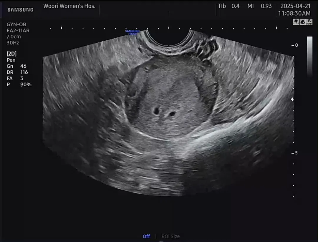 쌍둥이 일까요??