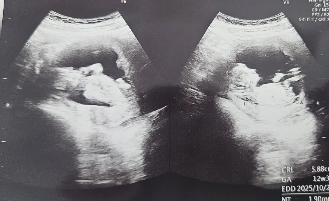 12주차 각도법 알수있을까요ㅠㅠ