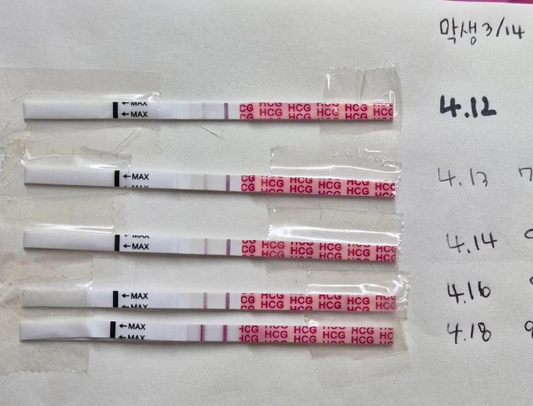 임테기! 아기집 볼수있을까요? 
