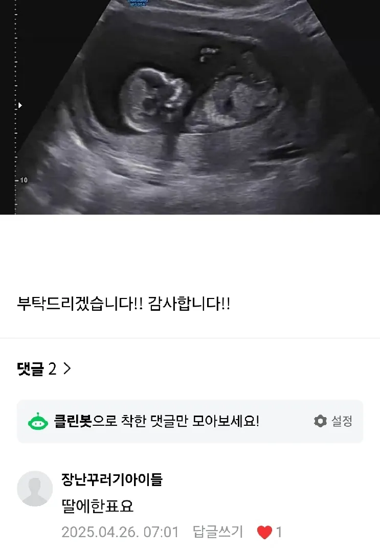 장꾸맘이 용하긴하네요 ㅎㅎㅎ