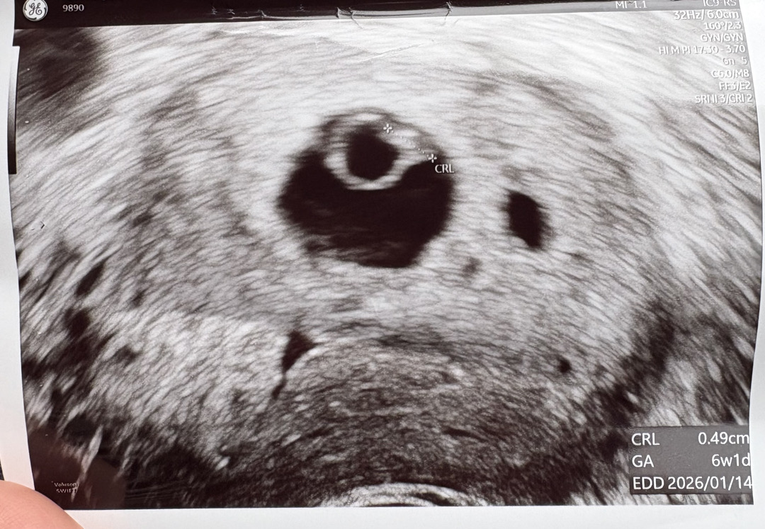 난황크기 느린심박수