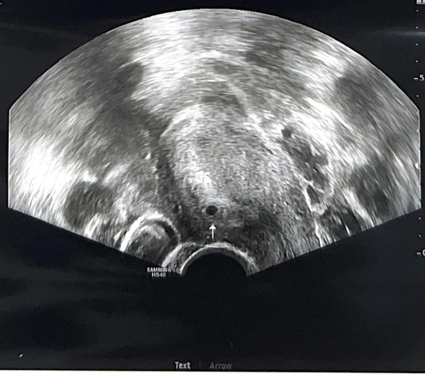 1/2 출산예정🍎👶🏻🤍
