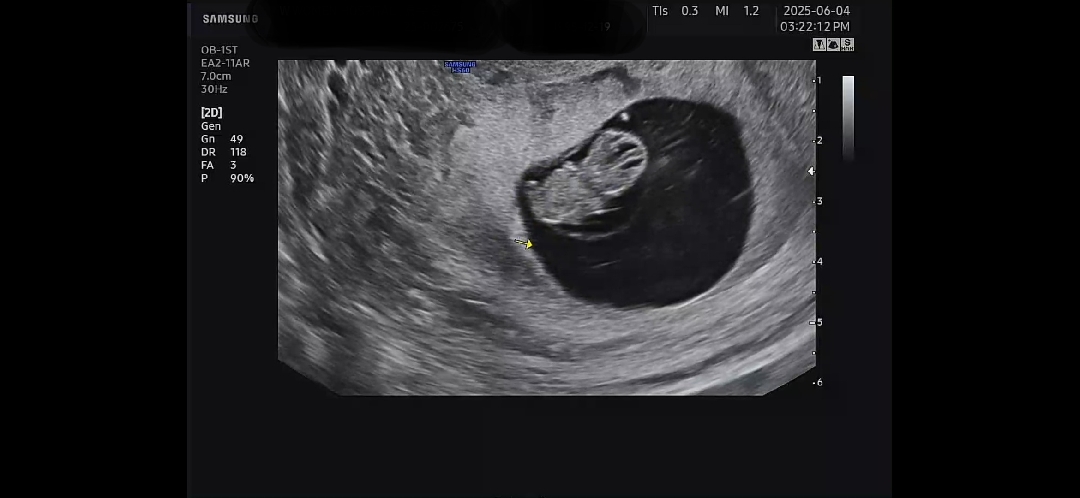 8주 5일차에 2등신 꼬물이 보고왔어요!