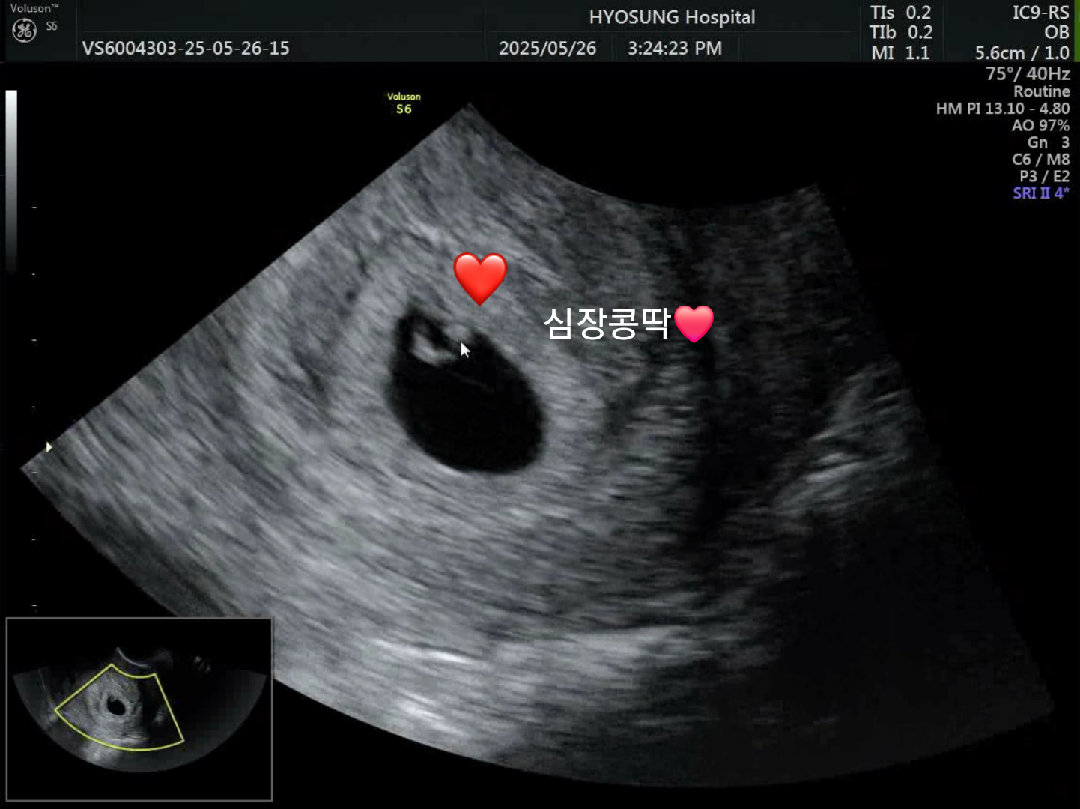 심장소리 듣구왔어요!