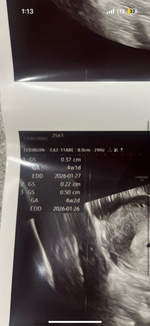 Gs1,2,3중에 어떤걸 봐야하나요?