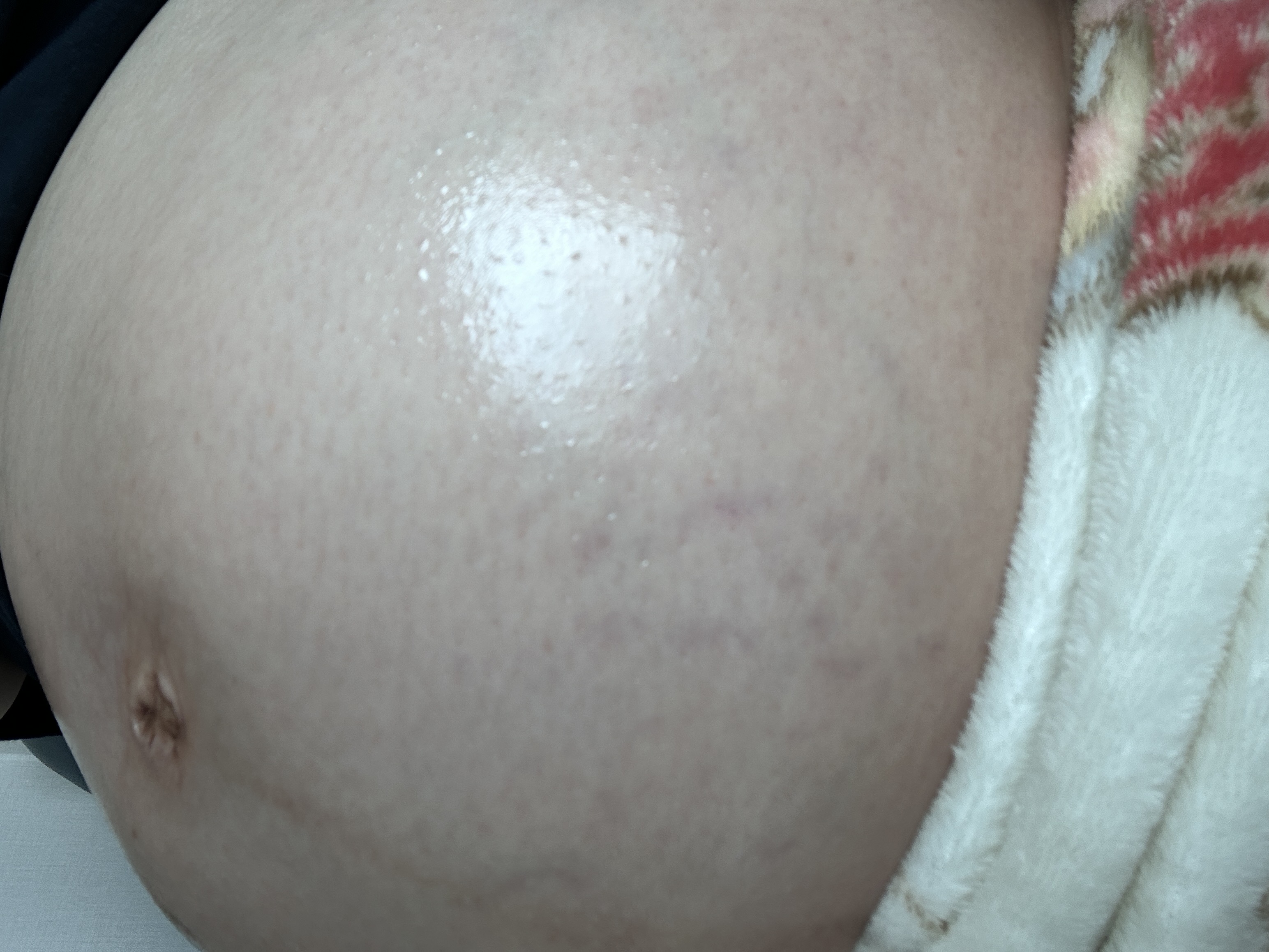 community post image