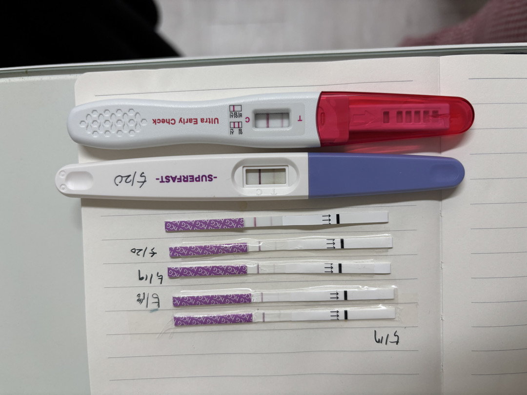 이럴때 언제 초음파를 보러가나요?