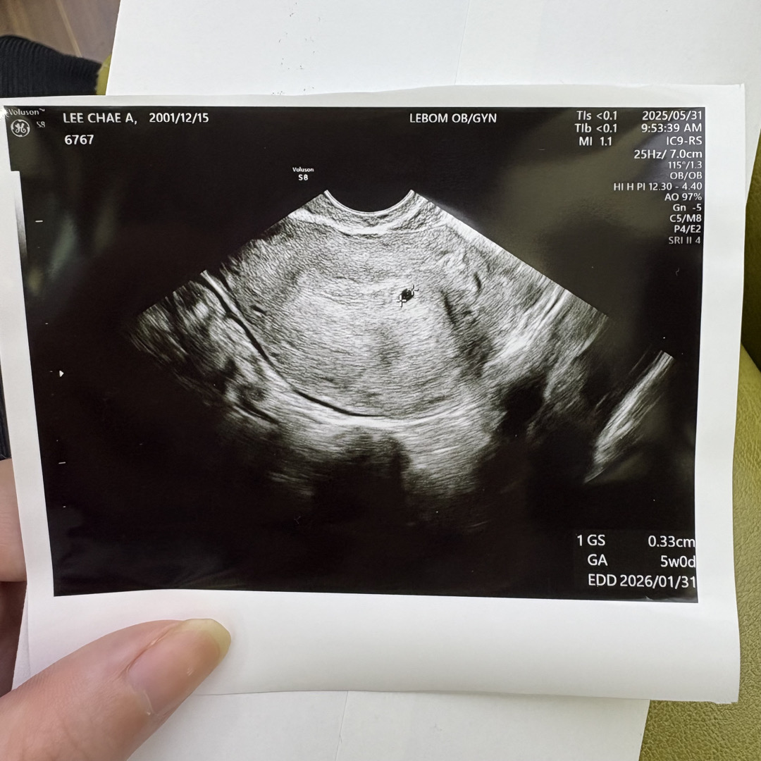 5월 31일에 첫 아기집 보고 왔어요ㅠ