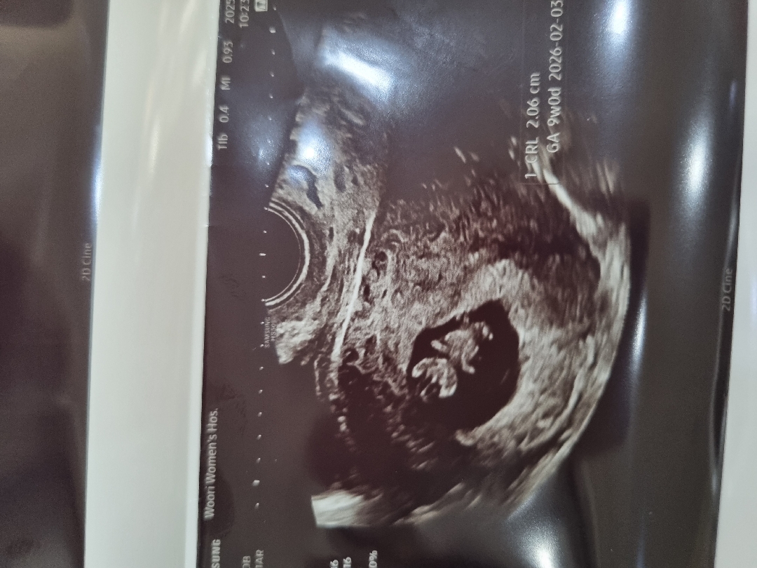 오히려 아기가 빨리자란분도있나요