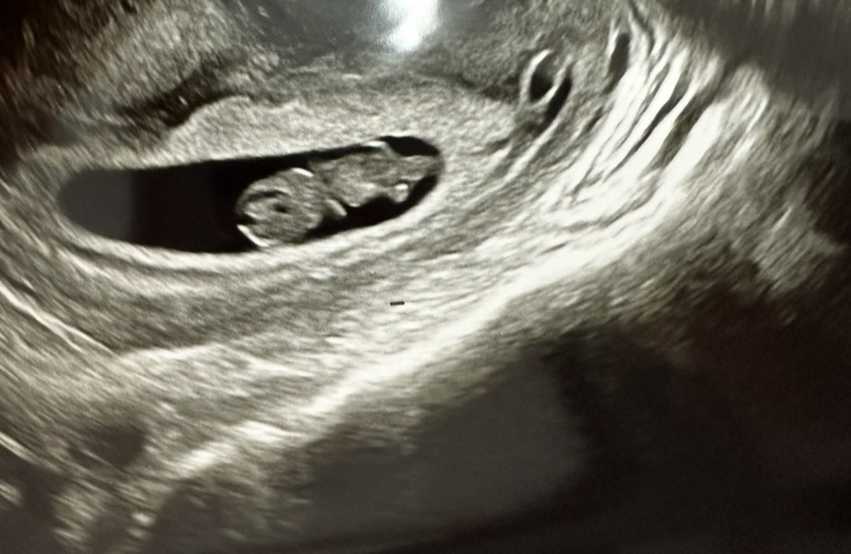 8주5일 젤리곰 보고왔어요!!