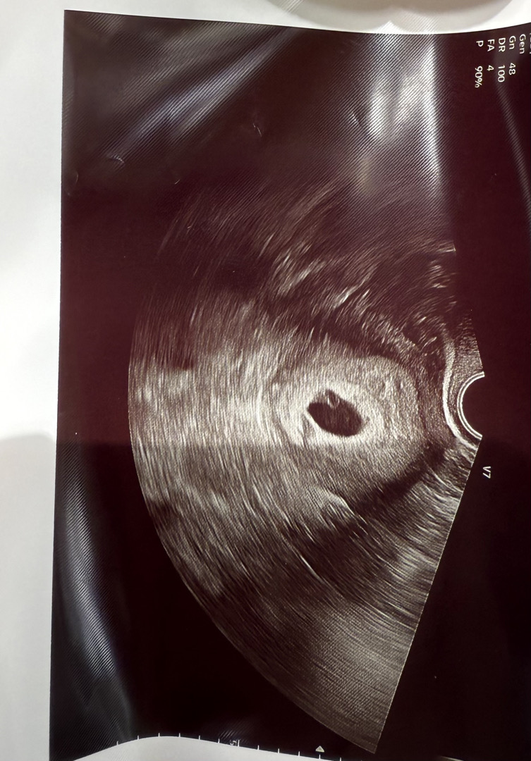 병원 마다 초음파