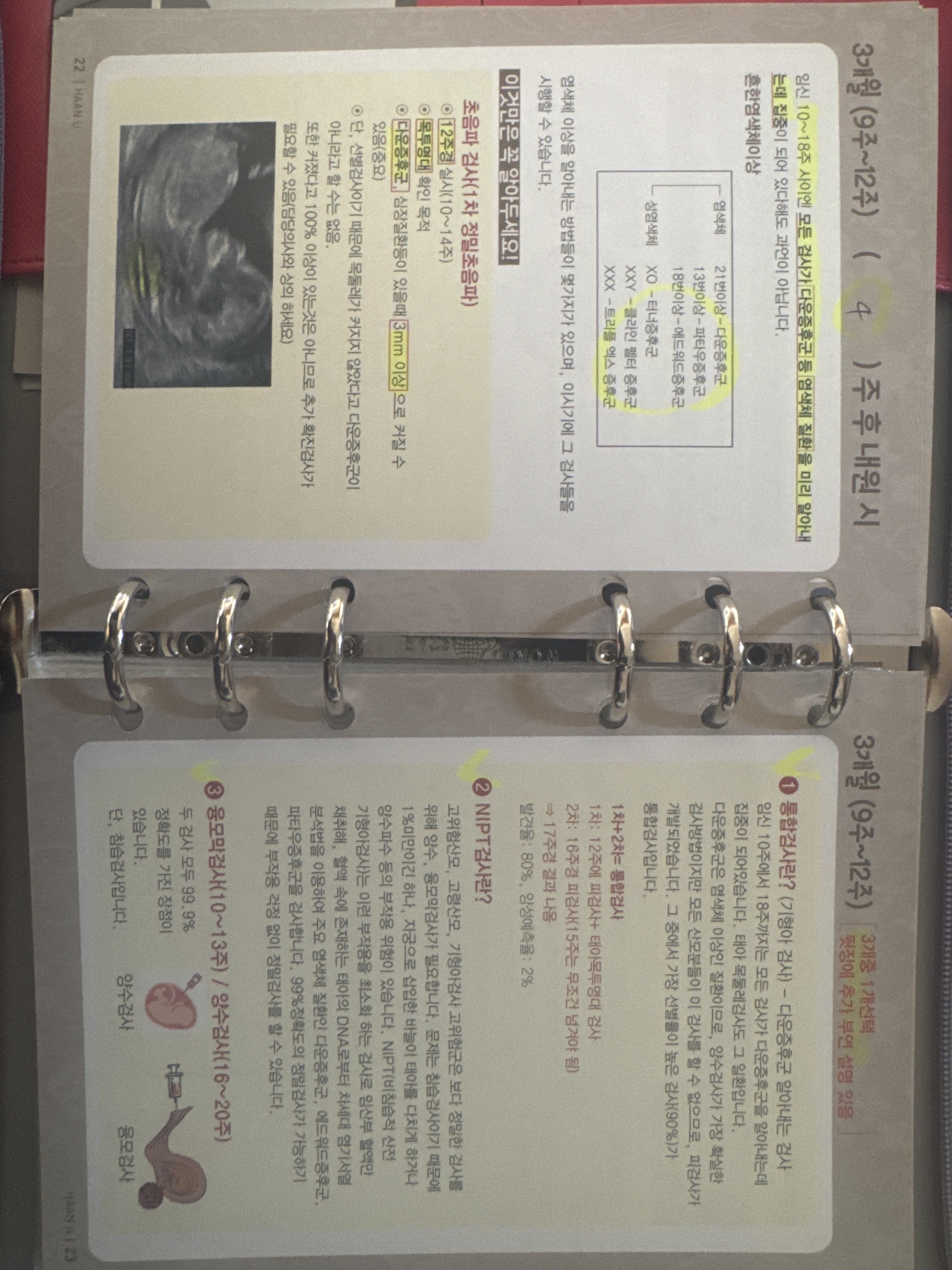 community post image