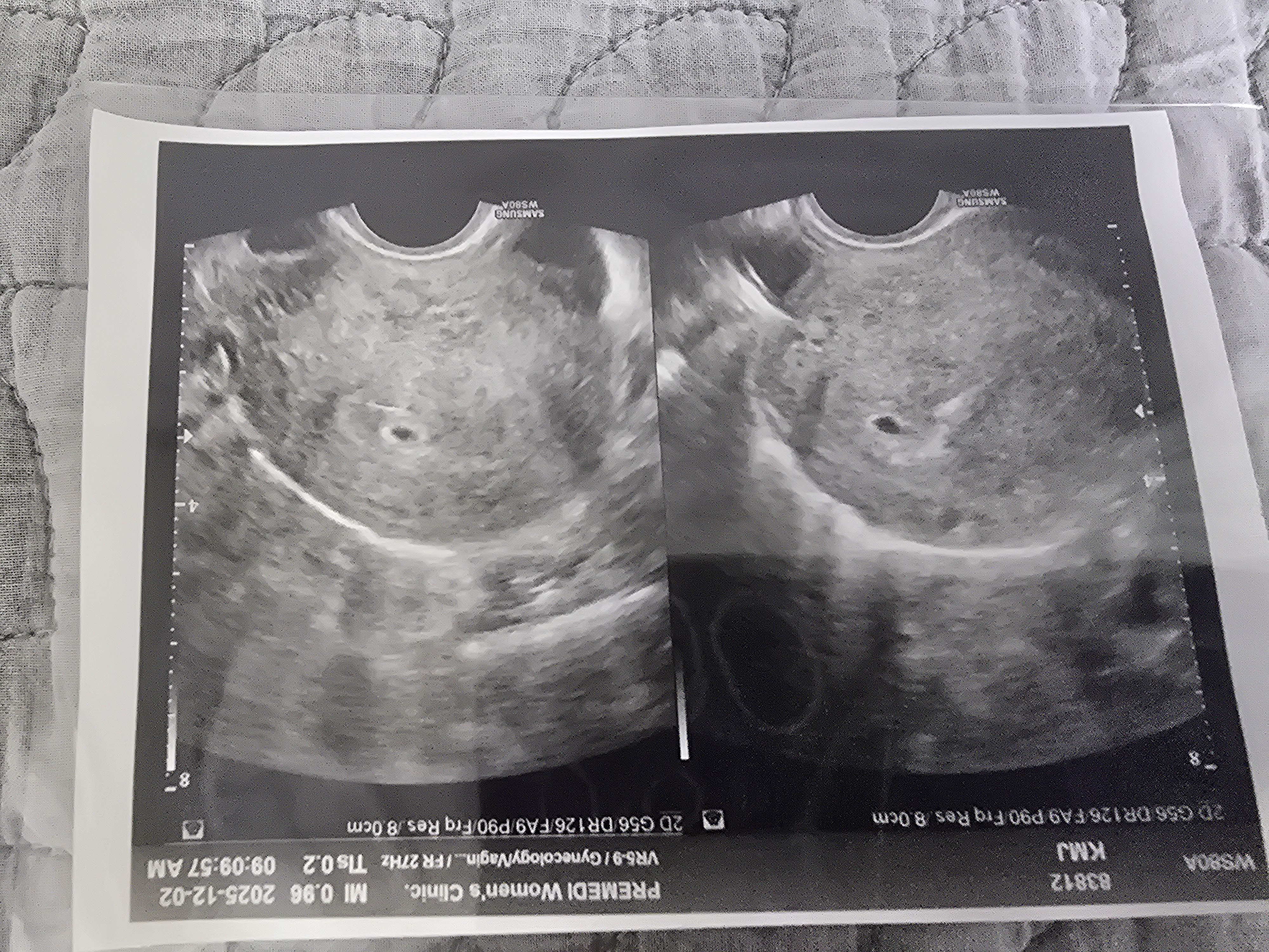 community post image