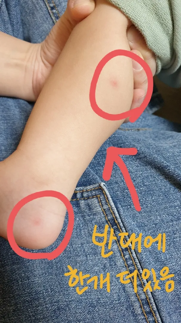 이 상처 뭔지 아세요??
