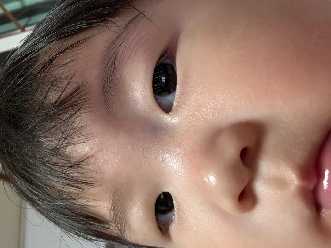 피부에 이거 멀까요 ??