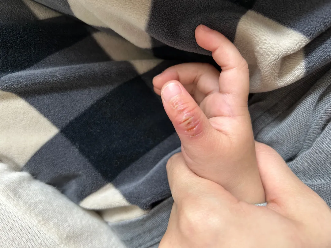 손가락 많이 빠는아가 ㅜㅜ