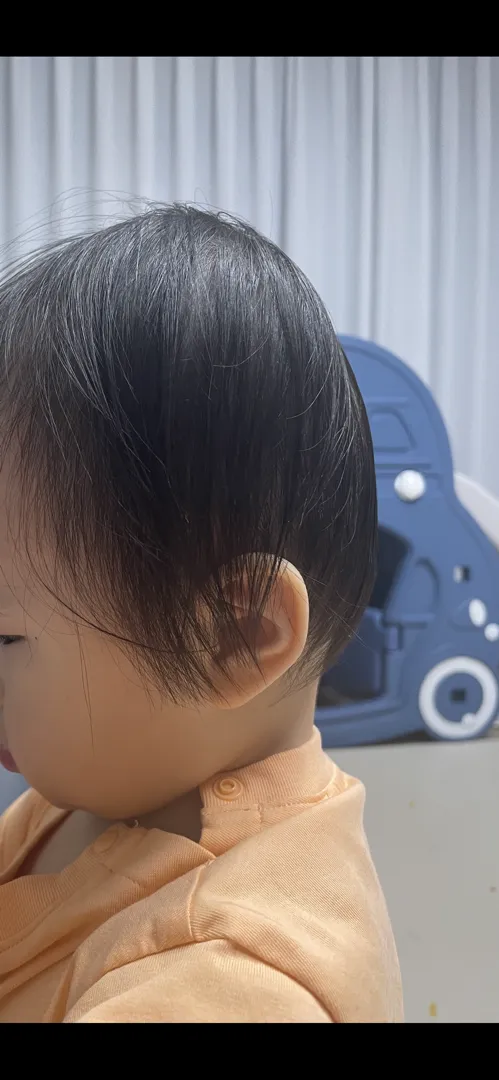아기 두상이요