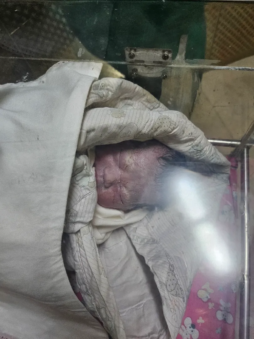 37주6일에 태어났어요~~