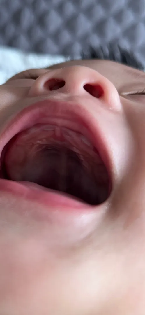 앞니 이렇게 나는게 맞아요..?