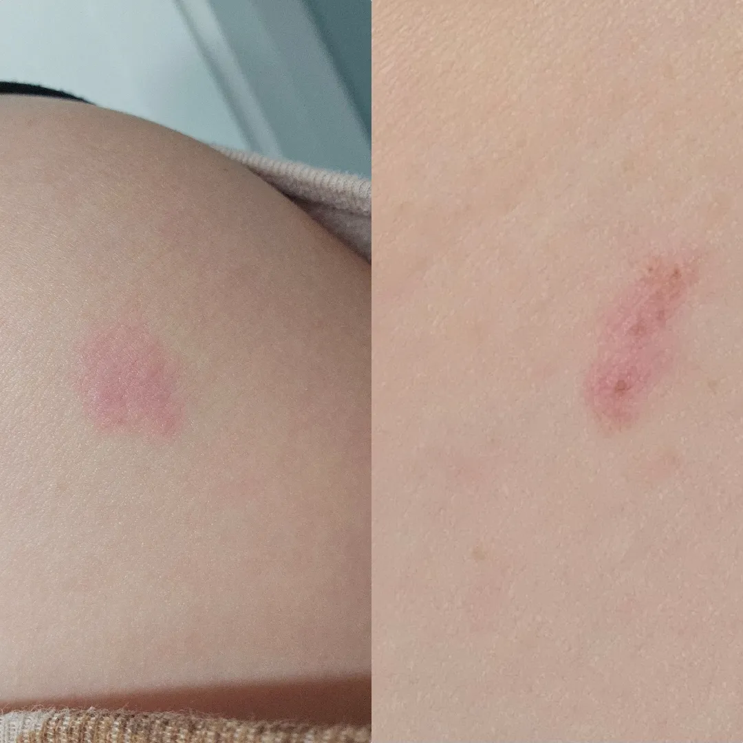 깨무는아기 어떻게 해야하나요