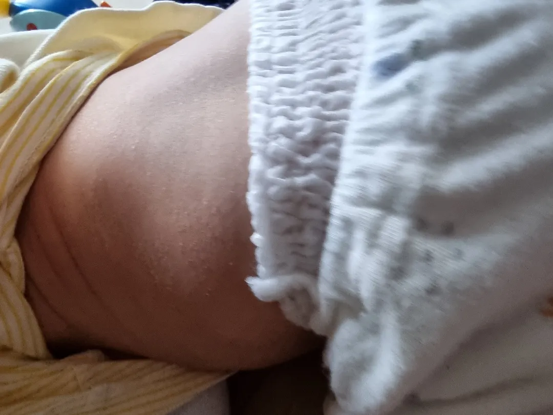 피부가 너무 건조해요