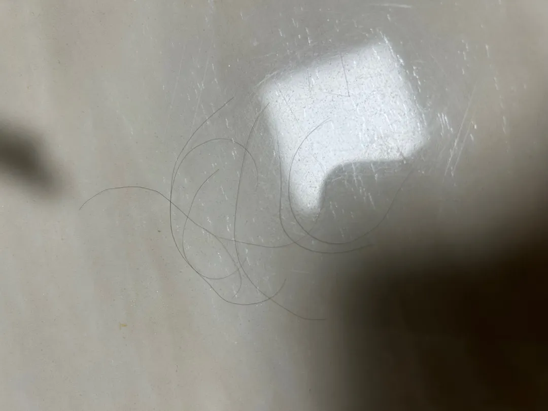 머리자꾸 쥐뜯어요ㅜㅜㅜ
