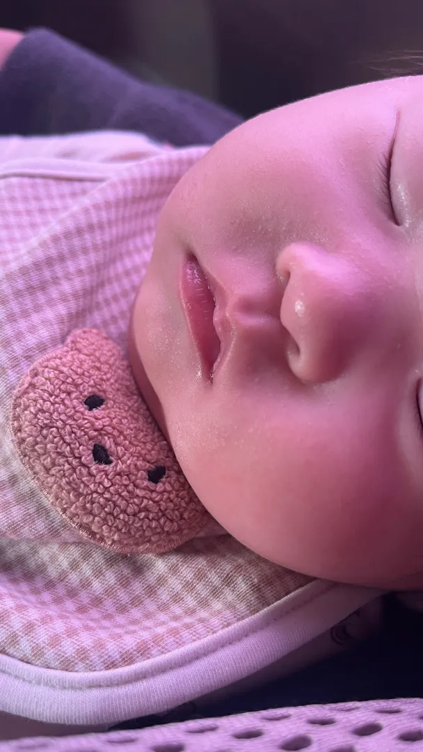 애기 입근처에 이게 침독일까요?