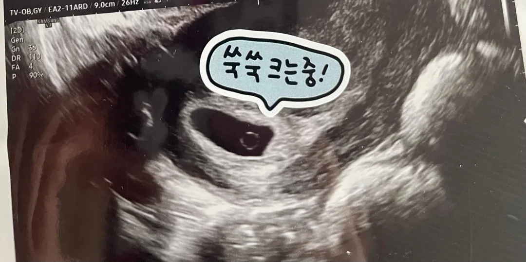 6주 2일차