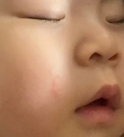 아기 얼굴좀 봐주세요ㅜ
