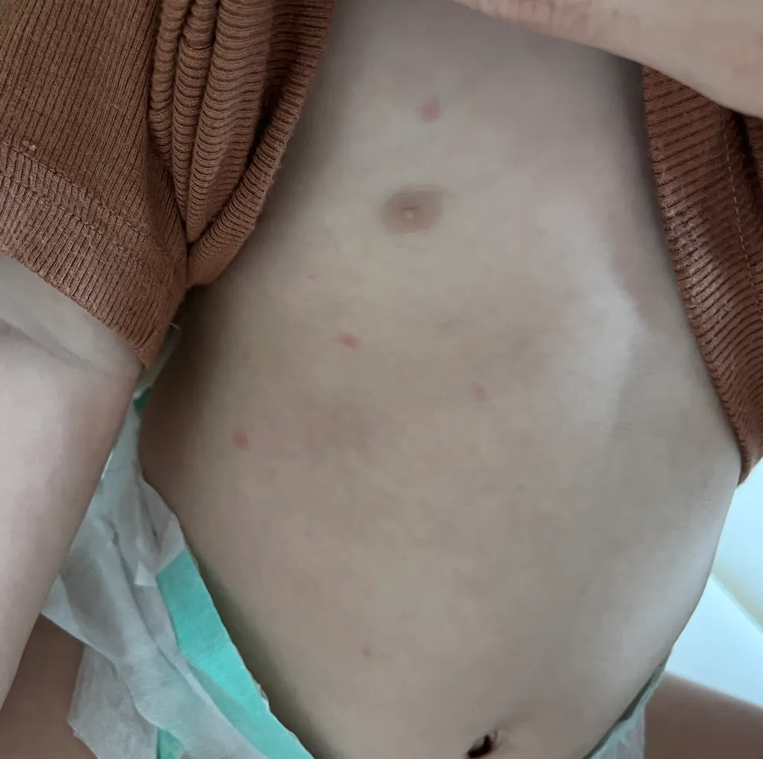 열꽃인가요?