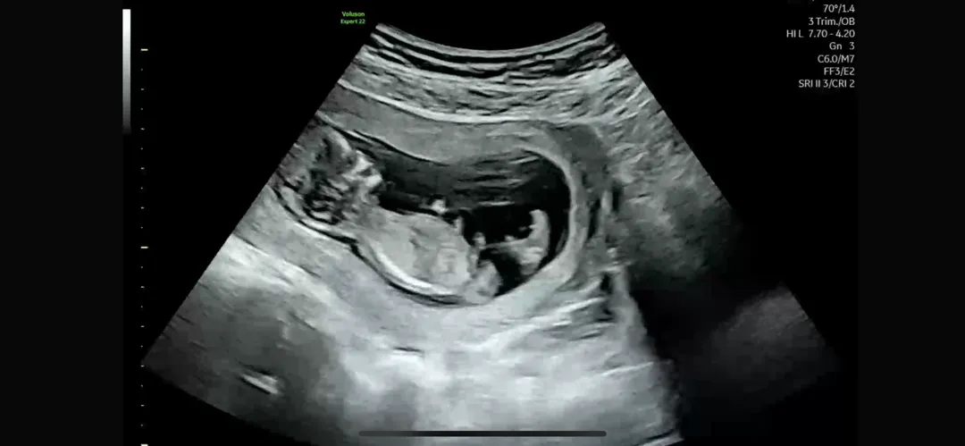 12주3일 각도법^^