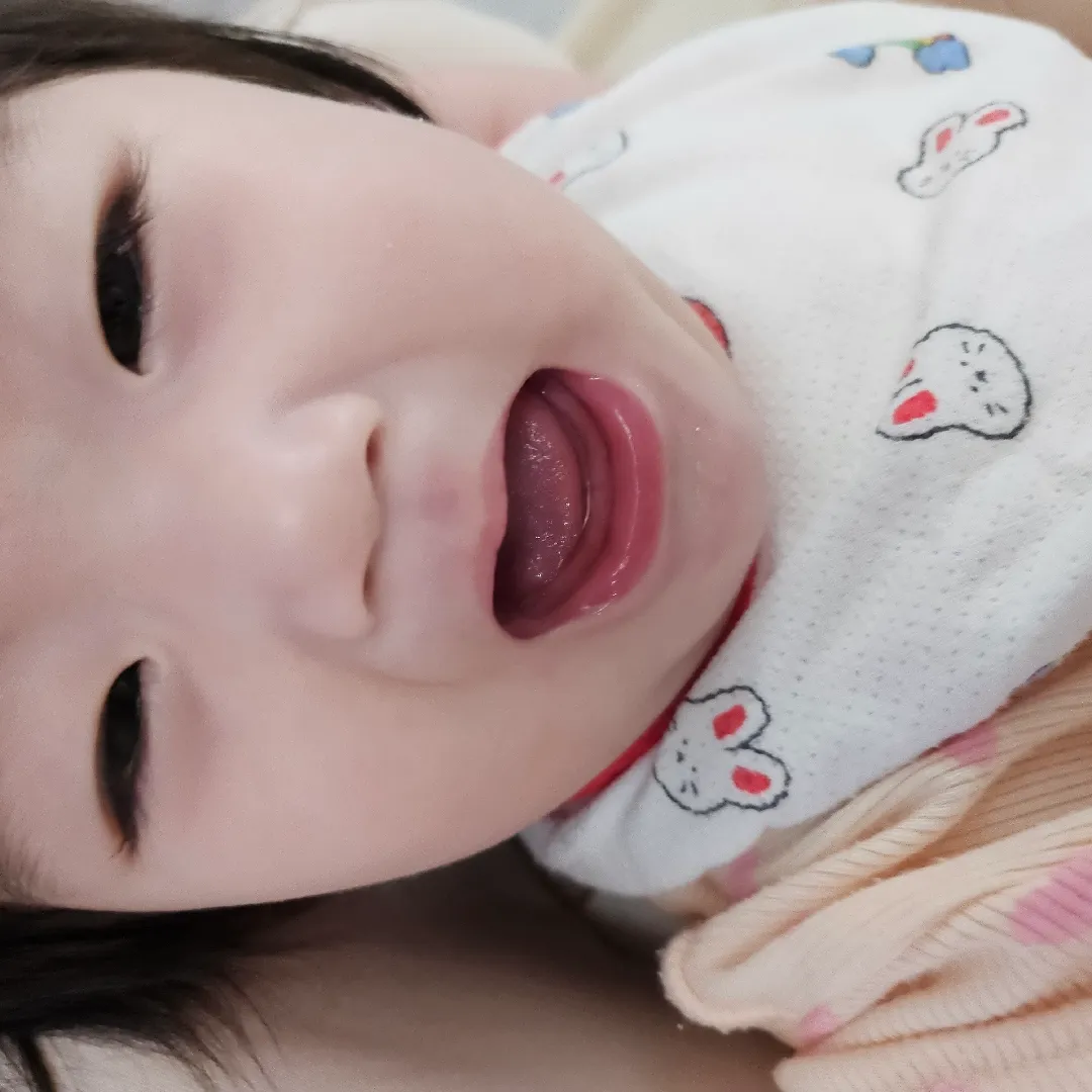 이가 언제나올까요ㅠㅠ