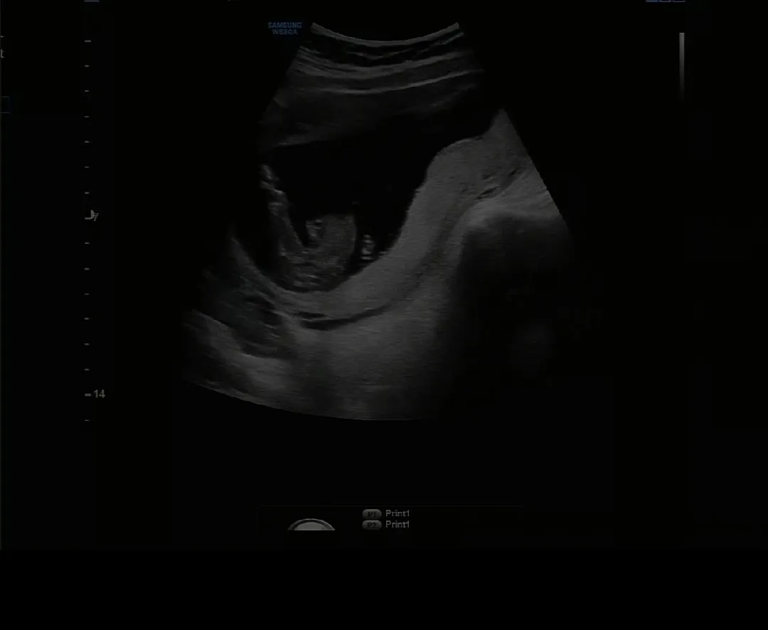 16주 딸인가요?