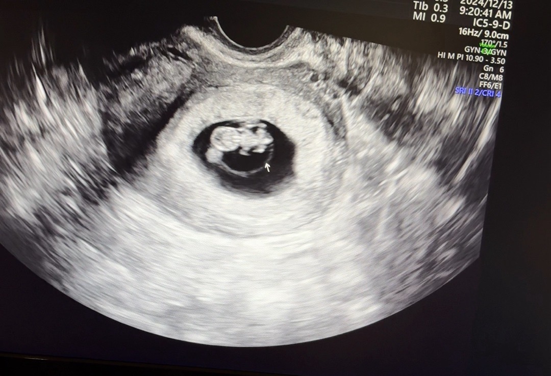 7주 6일 ❤️