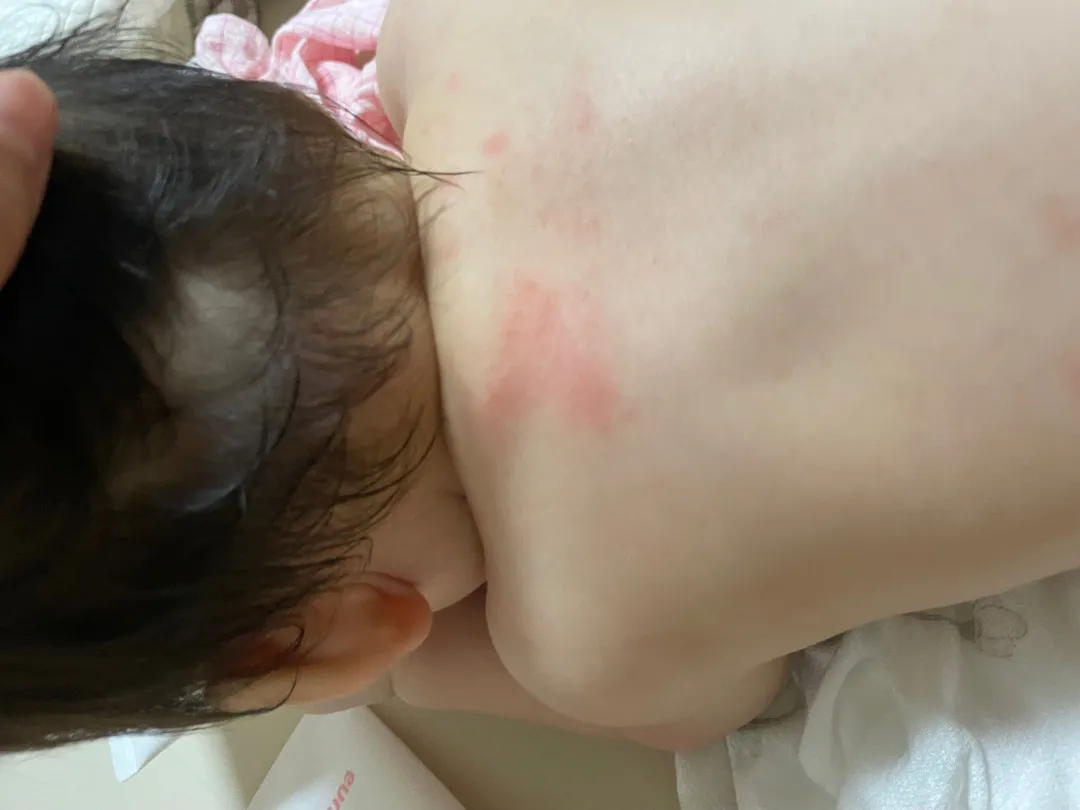 피부좀 봐주세요 ㅠㅠ 